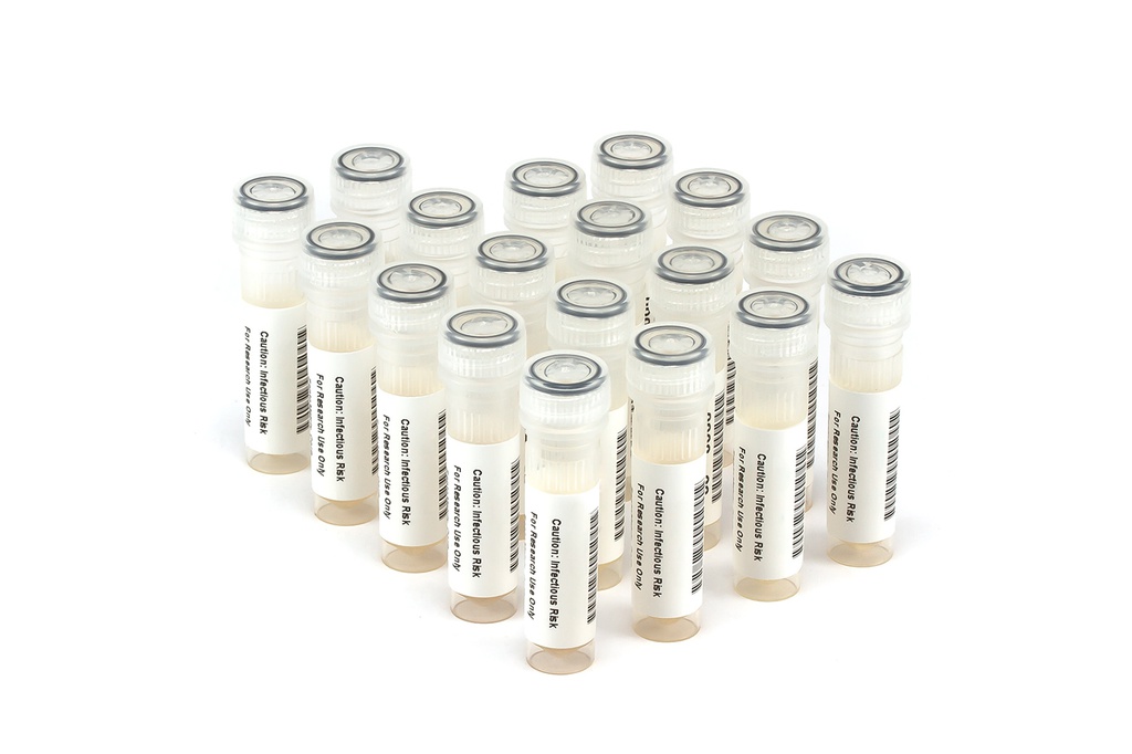 HBV11010 HBV Seroconversion Panel Donor n. 67457