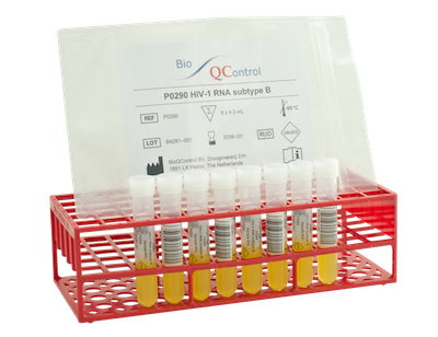 [P0053] P0053 HIV-1 RNA subtype F (1)